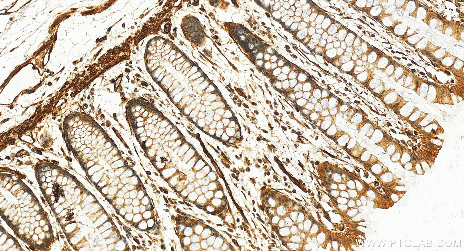 IHC staining of human normal colon using 12339-1-AP