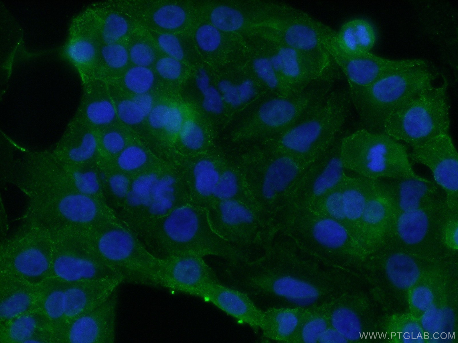 IF Staining of A549 using 12339-1-AP