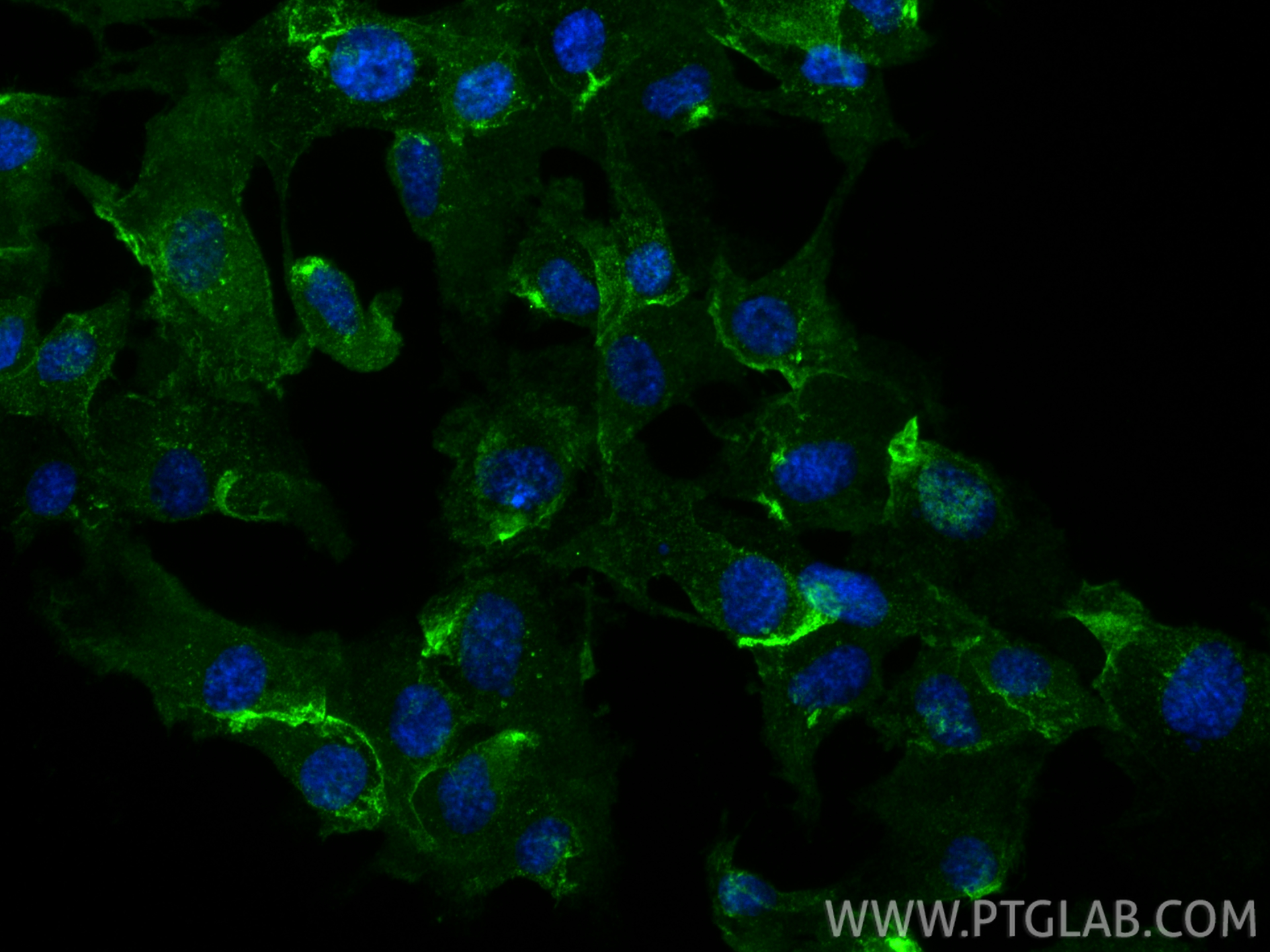 IF Staining of HUVEC using 61031-3-Ig IF Staining of HUVEC using 61031-3-Ig