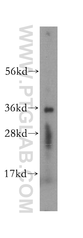 WB analysis of human adrenal gland using 16585-1-AP