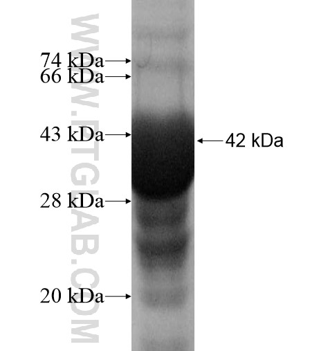 SDR42E1 fusion protein Ag11395 SDS-PAGE SDR42E1 fusion protein Ag11395 SDS-PAGE