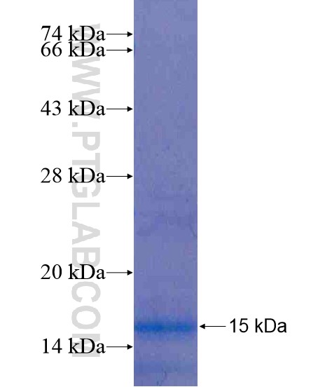 SDR9C7 fusion protein Ag20247 SDS-PAGE SDR9C7 fusion protein Ag20247 SDS-PAGE