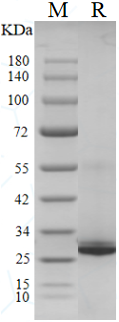 SDS-PAGE of SF65666-1-TR SDS-PAGE of SF65666-1-TR