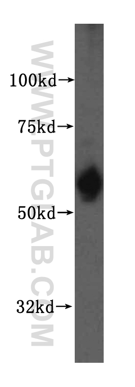 WB analysis of HepG2 using 16242-1-AP