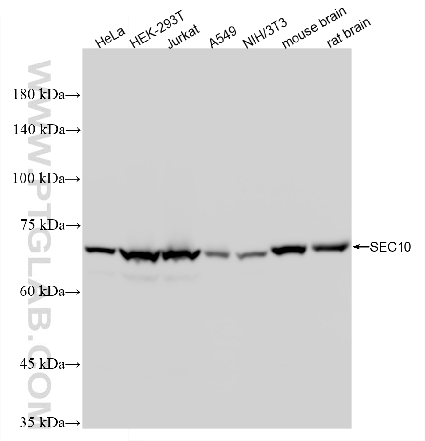 WB analysis using 87198-1-RR
