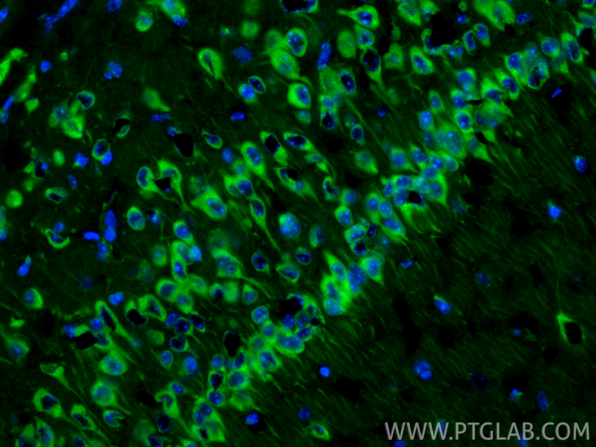 Immunofluorescent analysis of (4% PFA) fixed frozen OCT-embedded mouse brain tissue using SEC13 antibody (15397-1-AP) at dilution of 1:200 and CoraLite®488-Conjugated Goat Anti-Rabbit IgG(H+L) (<a class='green' href='/productredirect?CatalogNo=SA00013-2' target='_blank'>SA00013-2</a>). IF Staining of mouse brain using 15397-1-AP