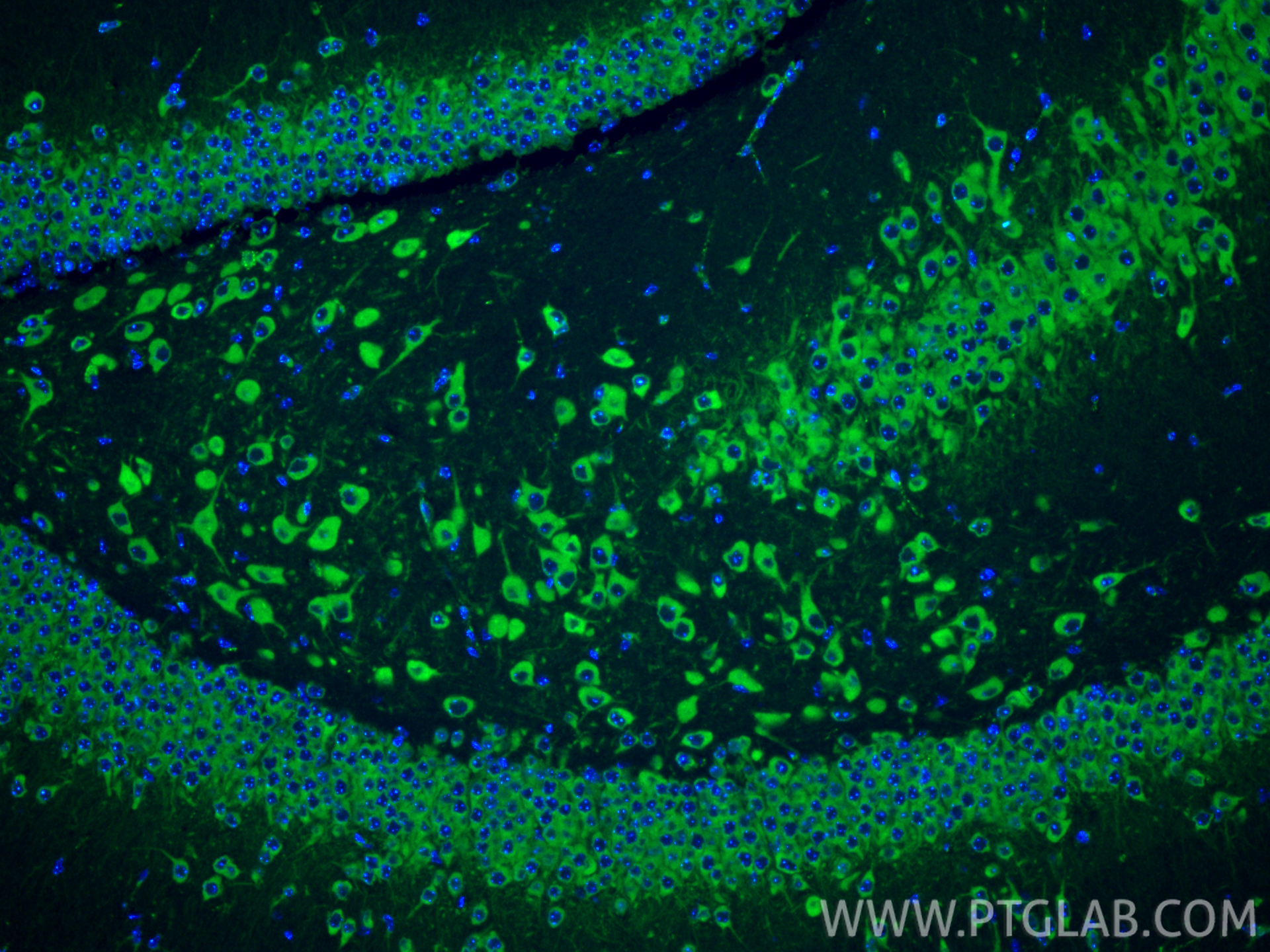Immunofluorescent analysis of (4% PFA) fixed paraffin-embedded mouse brain tissue using SEC13 antibody (15397-1-AP) at dilution of 1:200 and CoraLite®488-Conjugated Goat Anti-Rabbit IgG(H+L) (<a class='green' href='/productredirect?CatalogNo=SA00013-2' target='_blank'>SA00013-2</a>). Heat mediated antigen retrieval with Tris-EDTA buffer (pH 9.0). IF Staining of mouse brain using 15397-1-AP