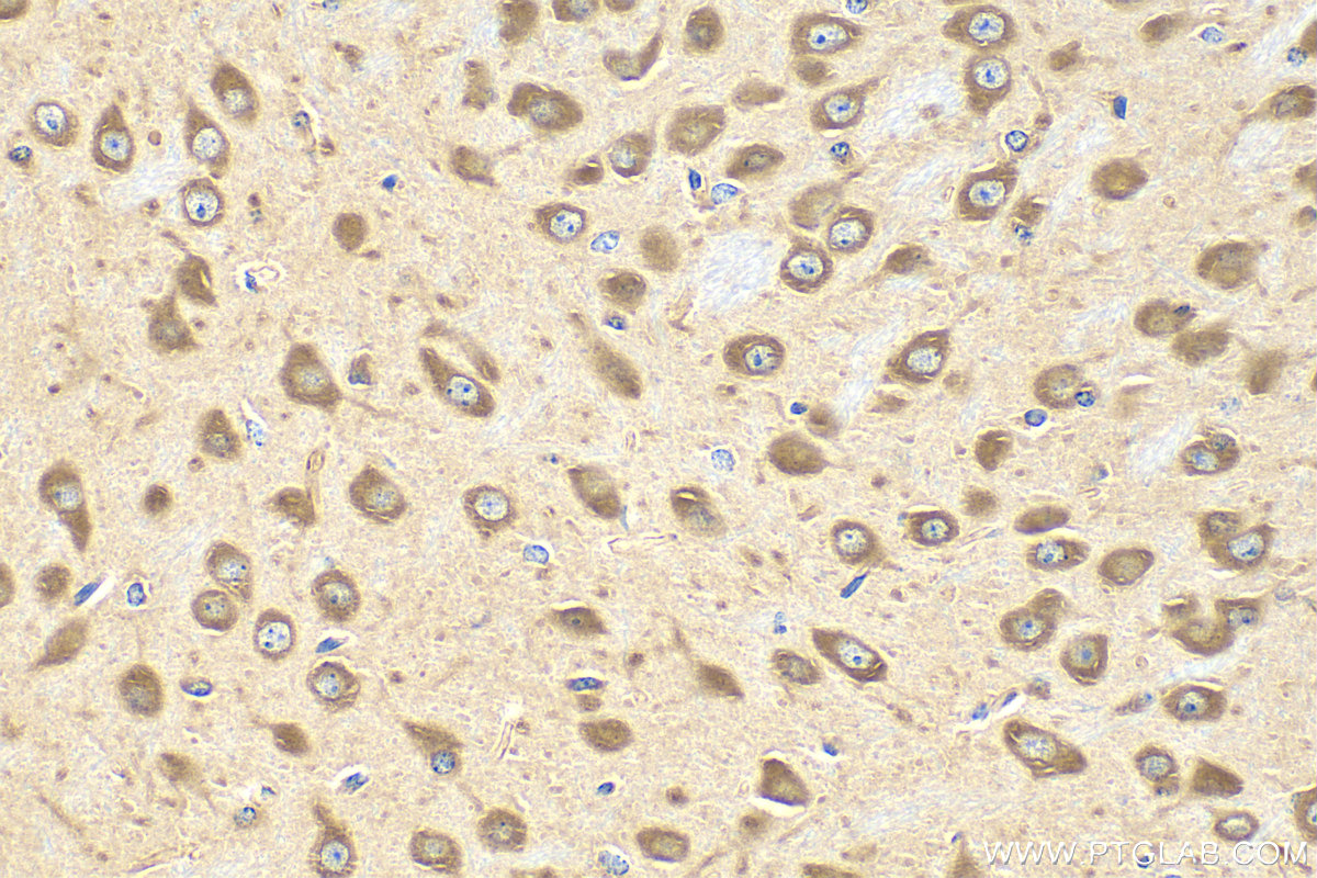 IHC staining of mouse brain using 15397-1-AP