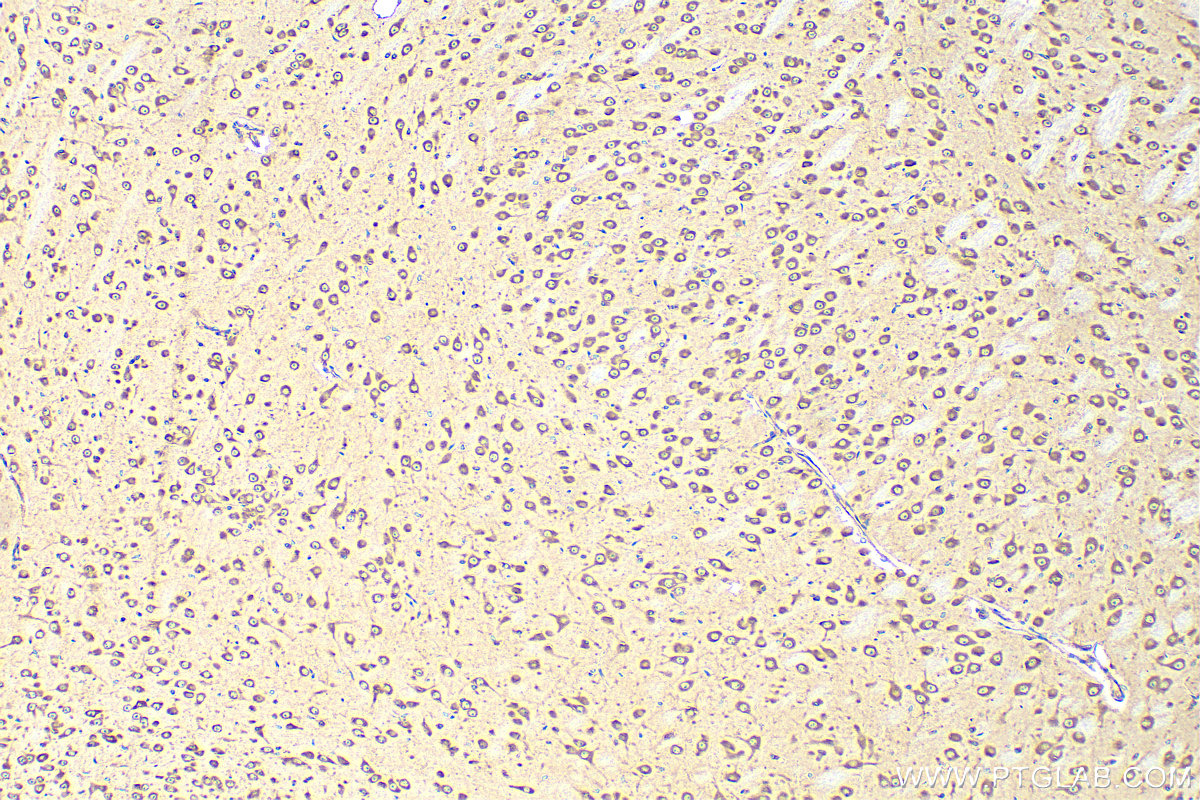 IHC staining of mouse brain using 15397-1-AP