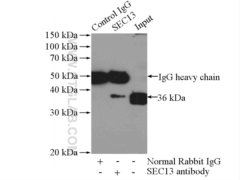 IP experiment of HepG2 using 15397-1-AP