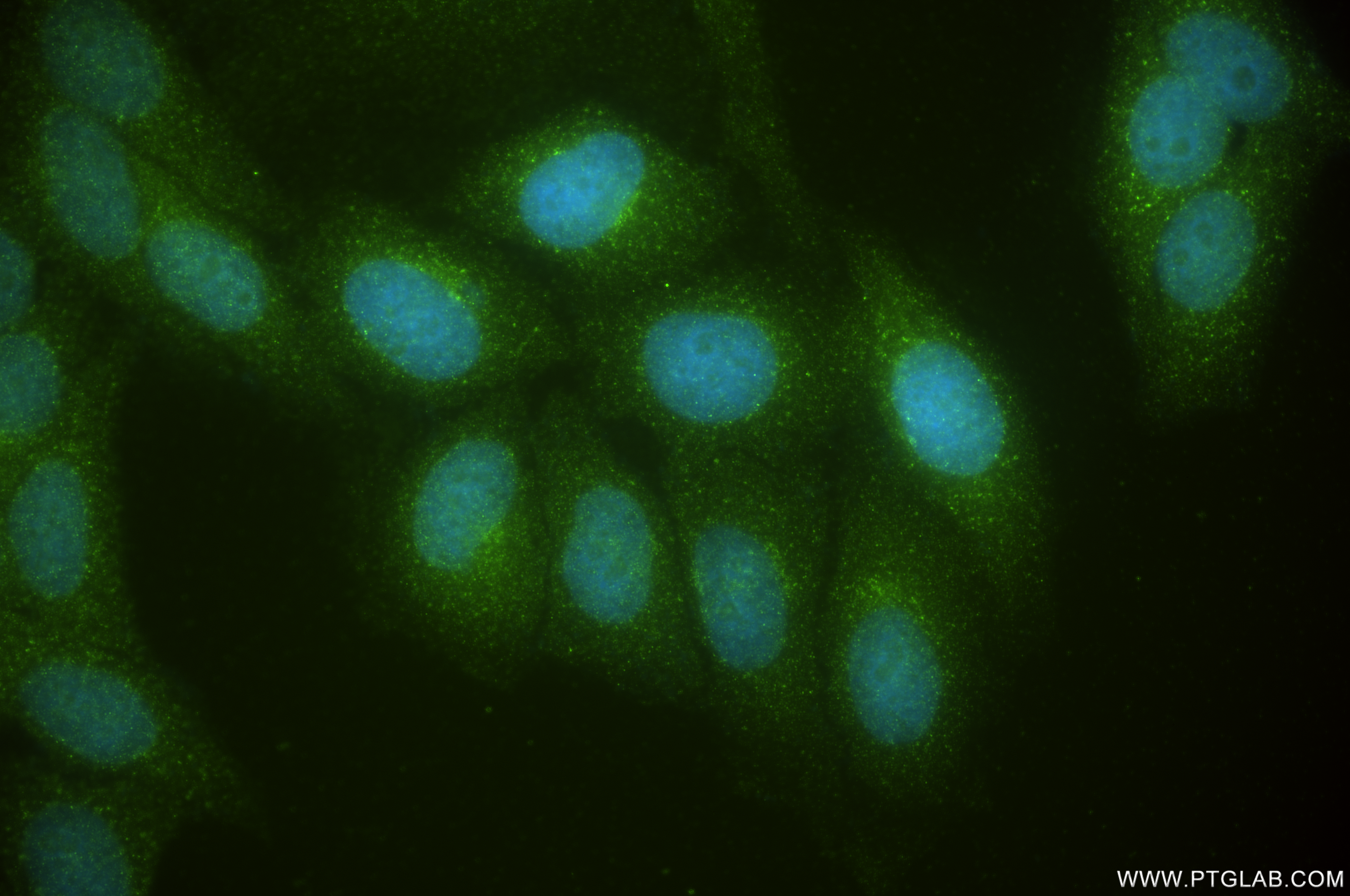 IF Staining of HepG2 using 85110-4-RR