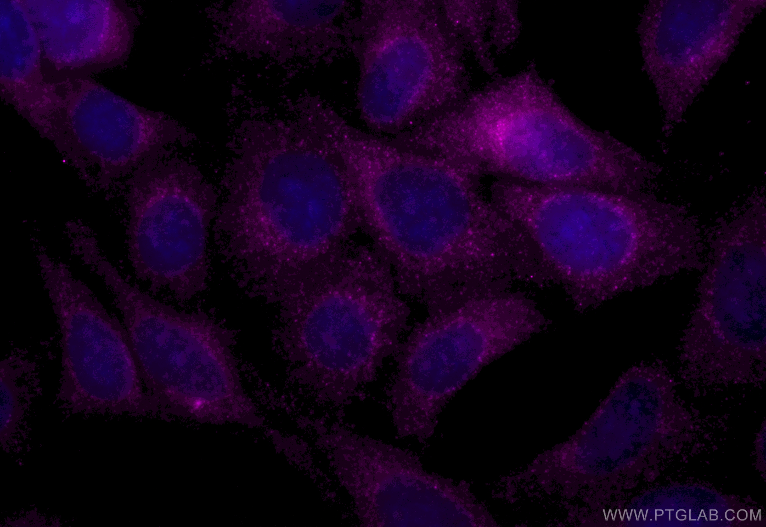 IF Staining of HepG2 using CL647-85110-4