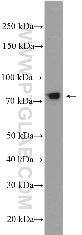 WB analysis of Y79 using 25541-1-AP