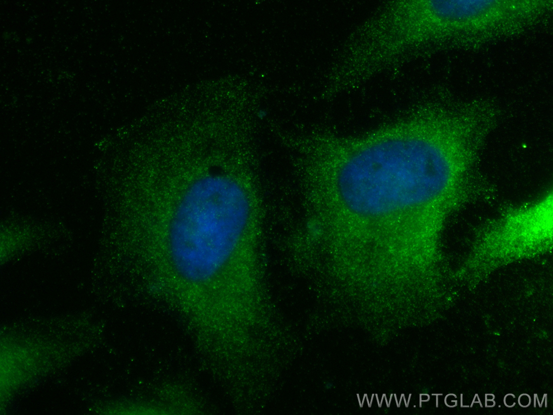 IF Staining of HeLa using 32098-1-AP