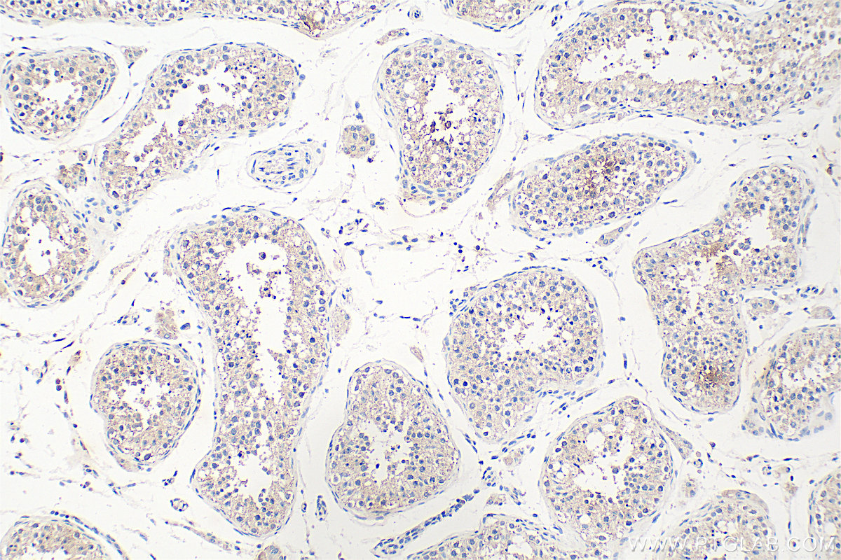 IHC staining of human testis using 32098-1-AP