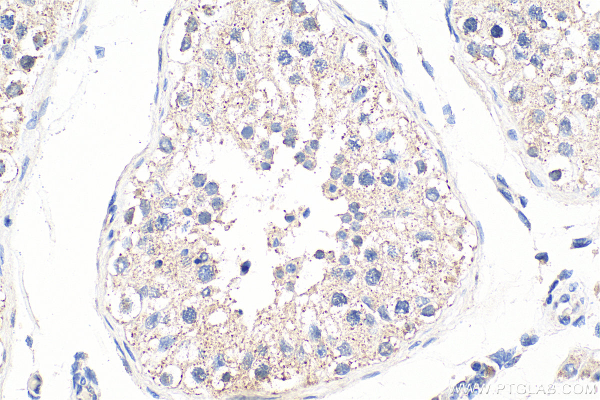IHC staining of human testis using 32098-1-AP
