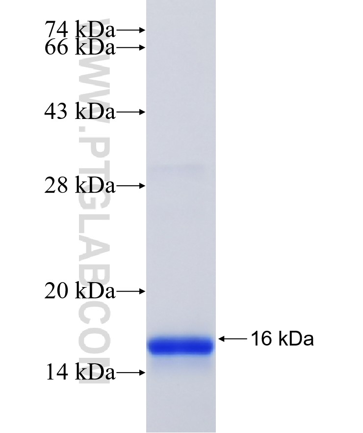 SEC14L4 fusion protein Ag23104 SDS-PAGE SEC14L4 fusion protein Ag23104 SDS-PAGE