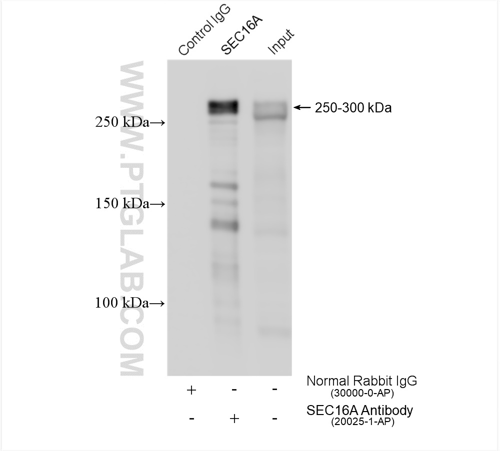 IP experiment of HeLa using 20025-1-AP