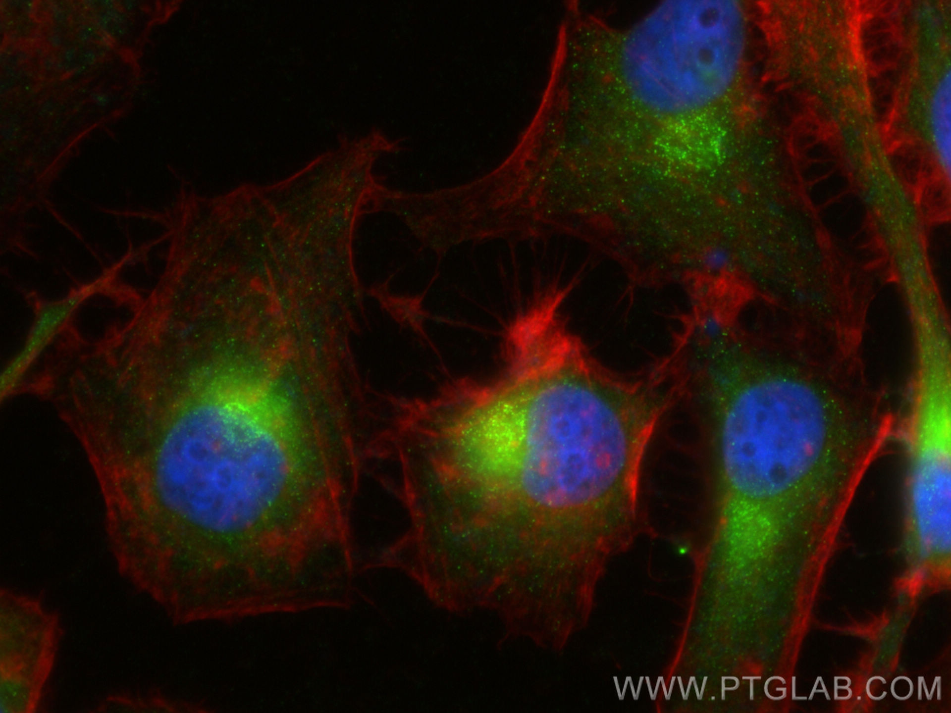 IF Staining of HeLa using 29417-1-AP