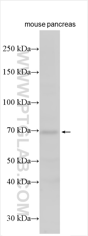 WB analysis using 17245-1-AP