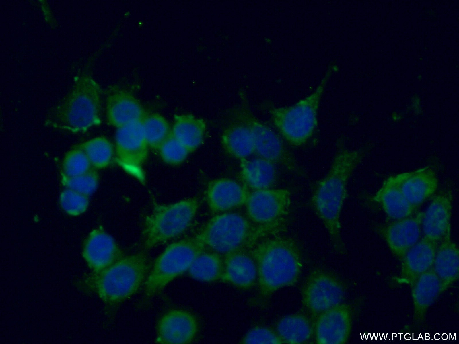 IF Staining of MCF-7 using 14776-1-AP