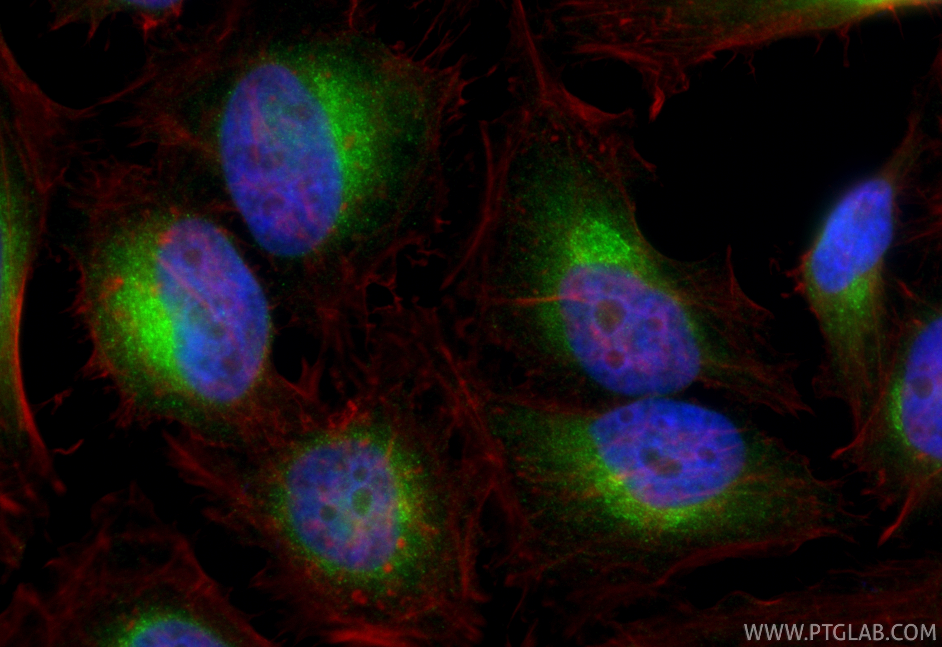 IF Staining of HeLa using 14776-1-AP