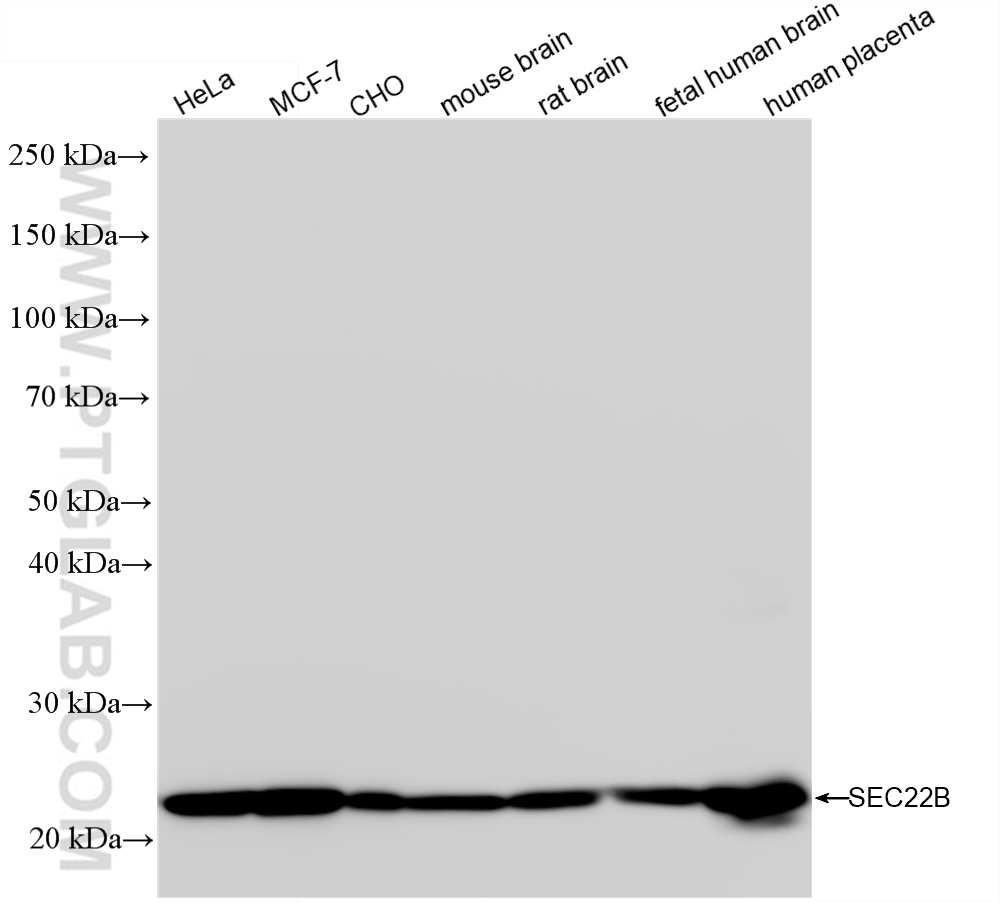 WB analysis using 85037-5-RR