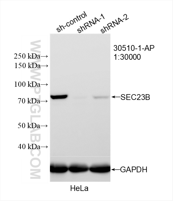 WB analysis of HeLa using 30510-1-AP