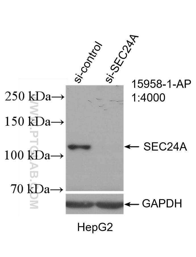 WB analysis of HeLa using 15958-1-AP