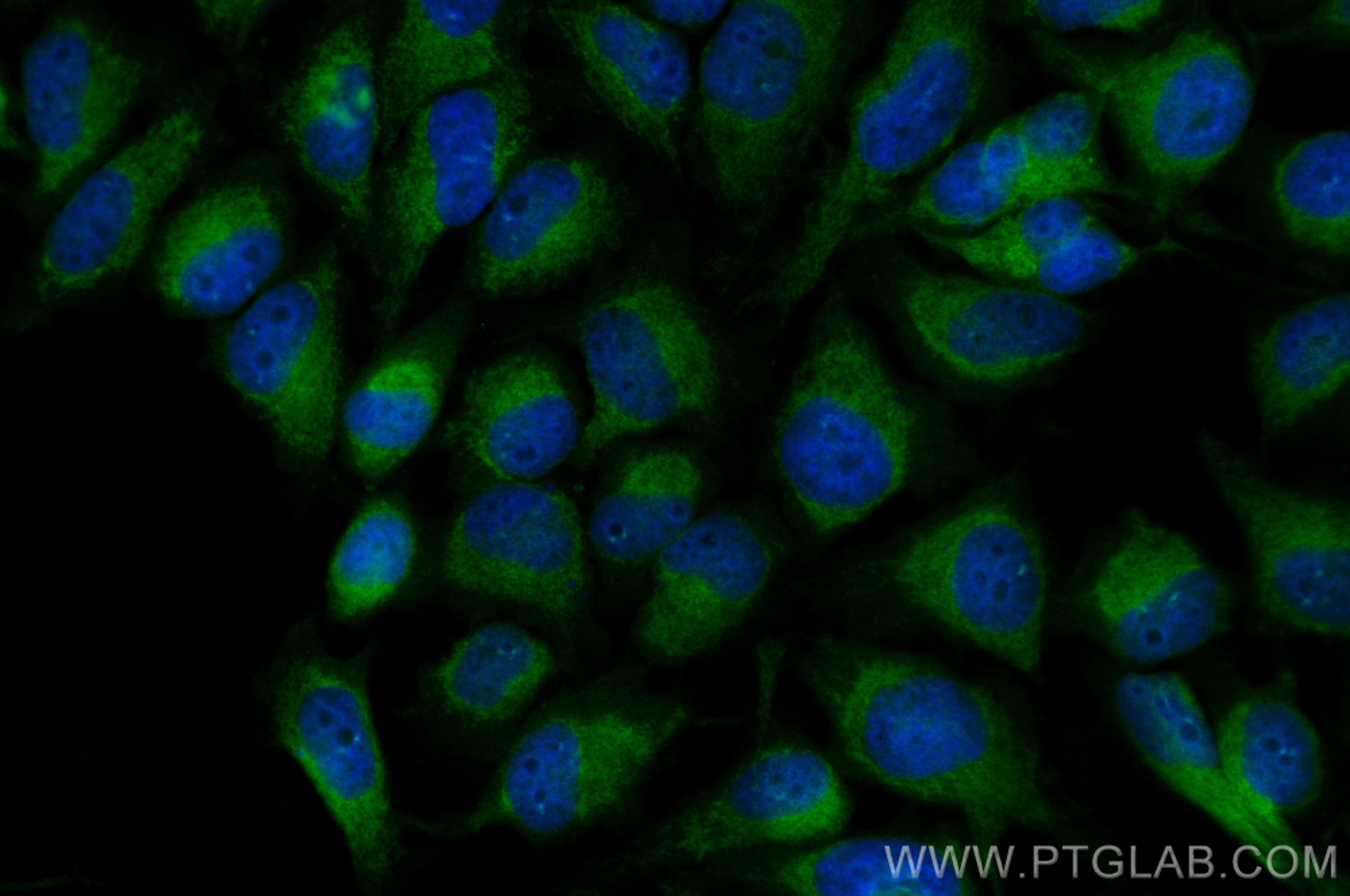 IF Staining of HeLa using CL488-82908