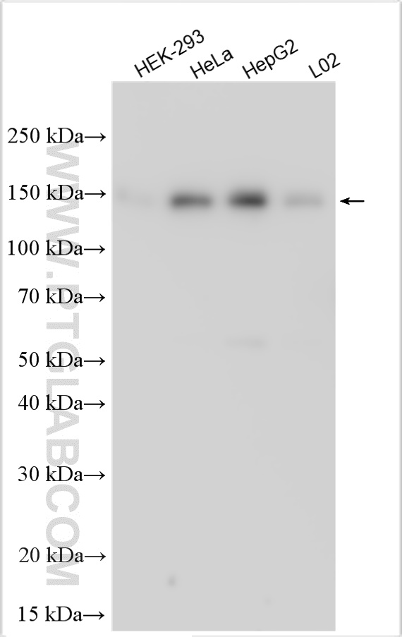 WB analysis using 32225-1-AP