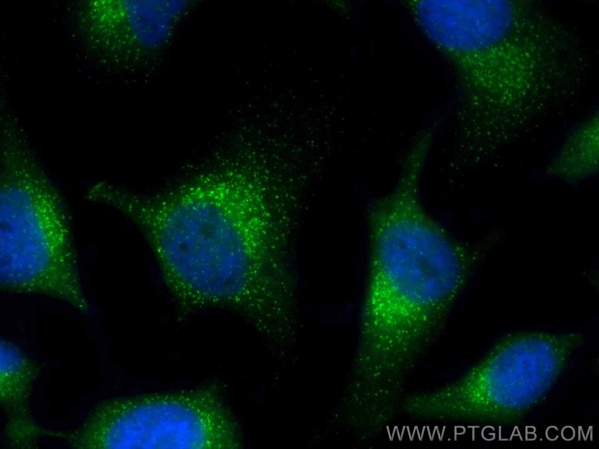 IF Staining of HeLa using 17913-1-AP