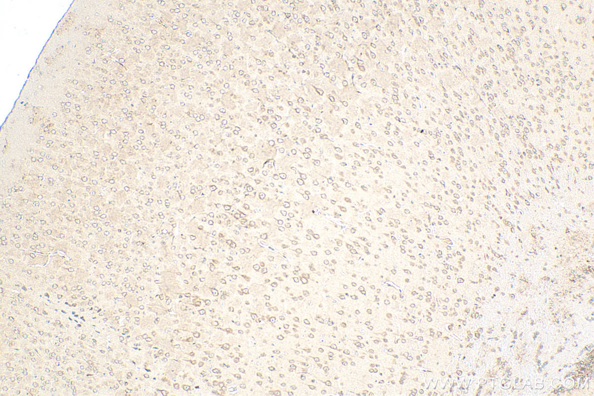 IHC staining of mouse brain using 17913-1-AP