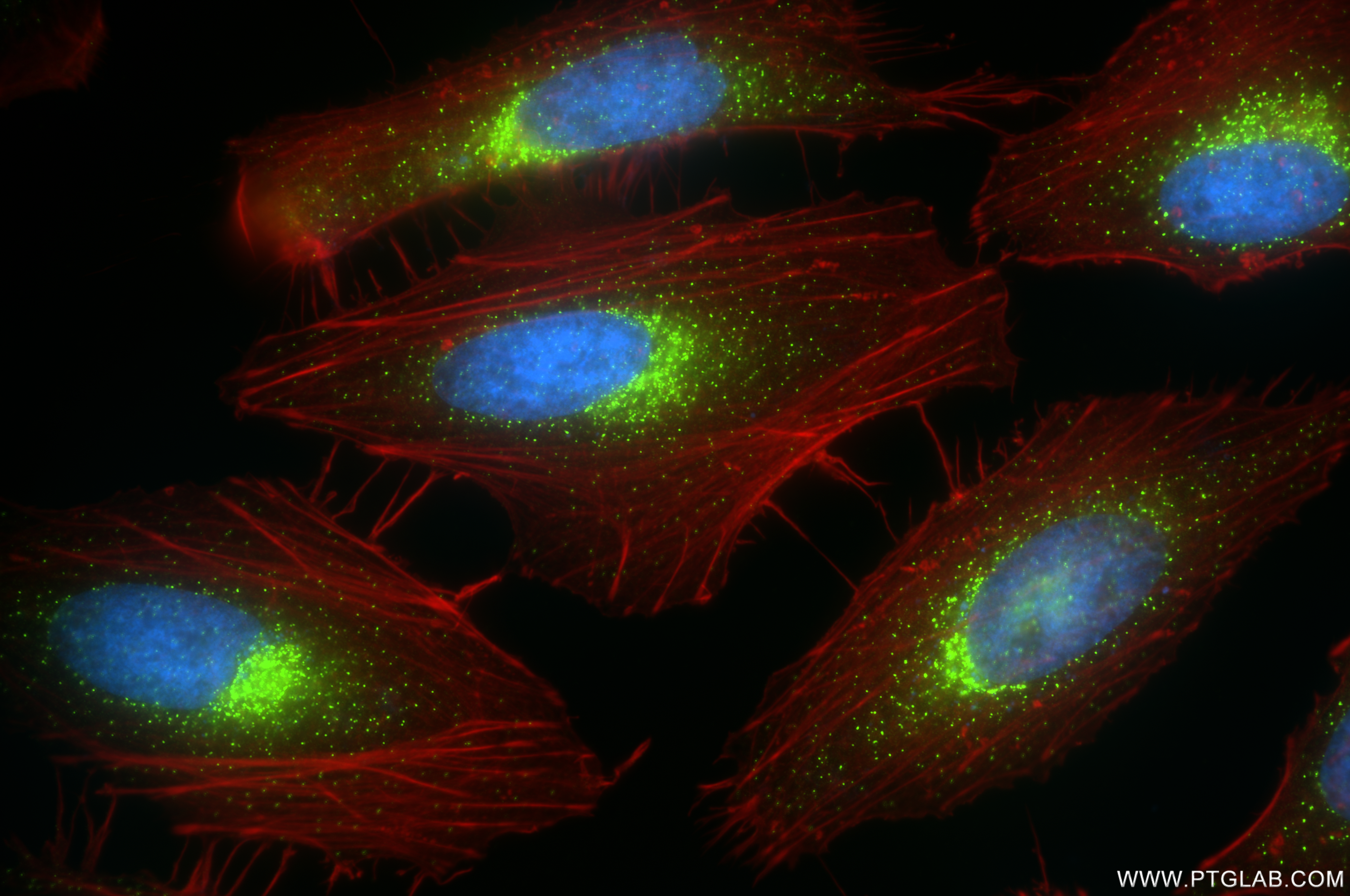 IF Staining of HeLa using 84942-4-RR