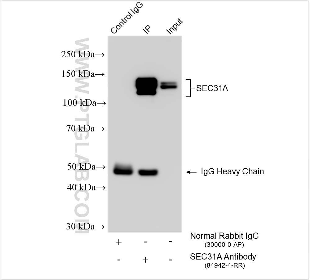 IP experiment of HeLa using 84942-4-RR