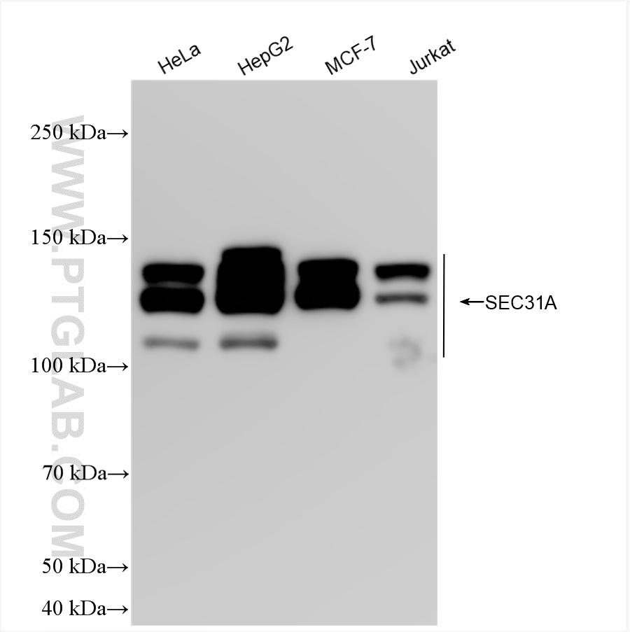 WB analysis using 84942-4-RR