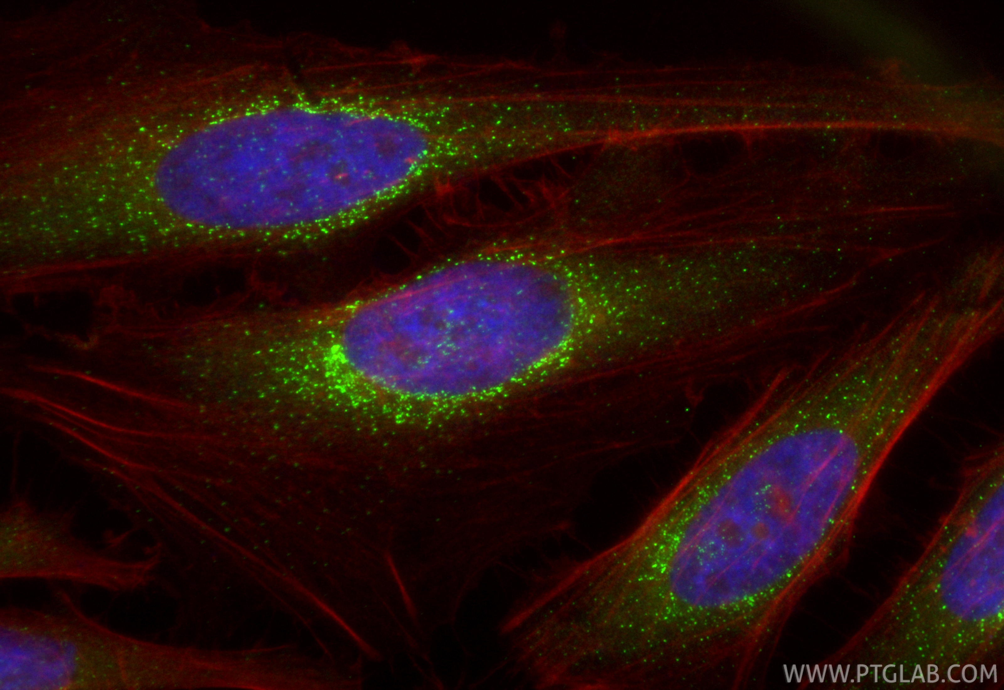 IF Staining of HeLa using CL488-84942-4