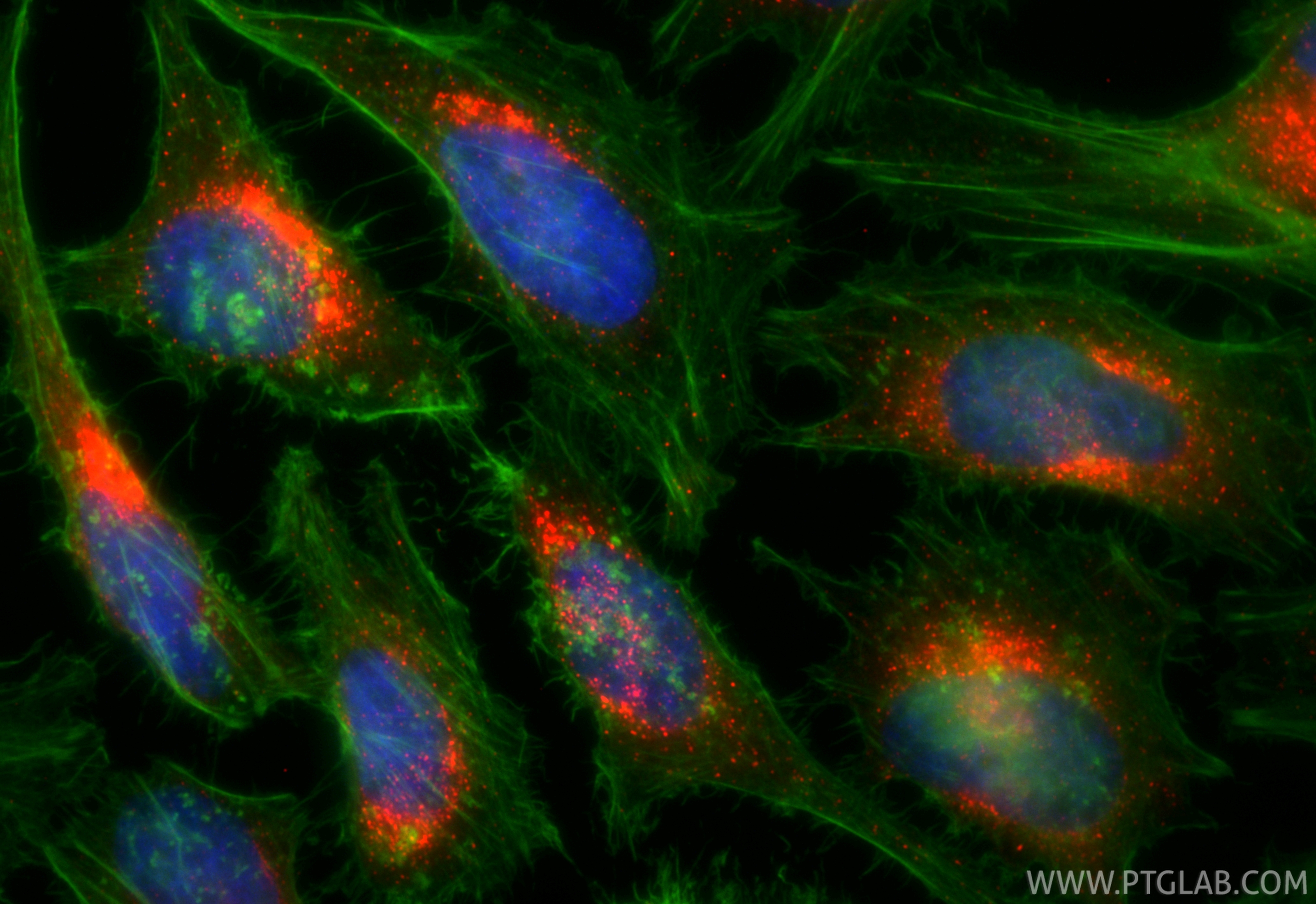 IF Staining of HeLa using CL594-84942-4