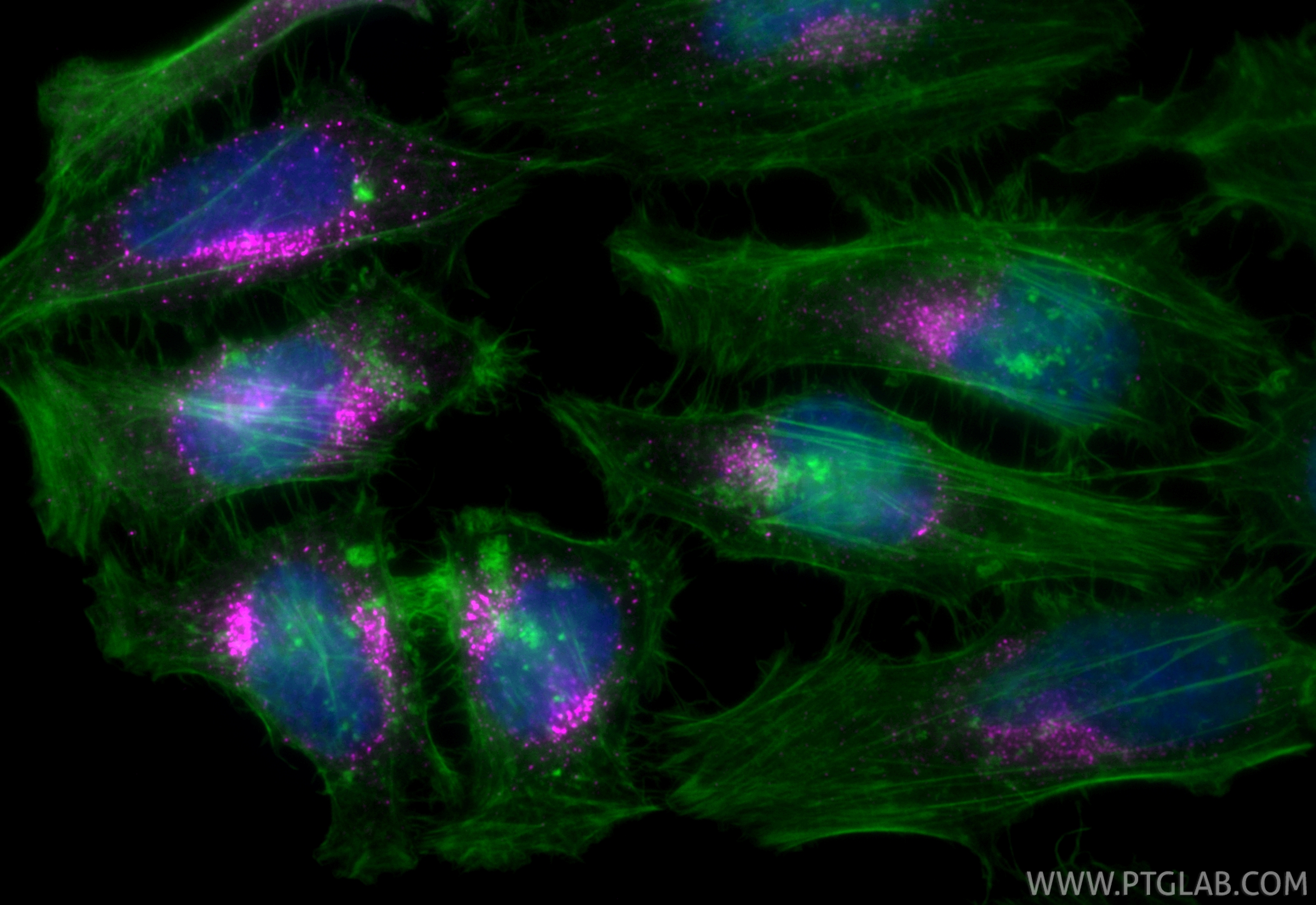 IF Staining of HeLa using CL647-84942-4