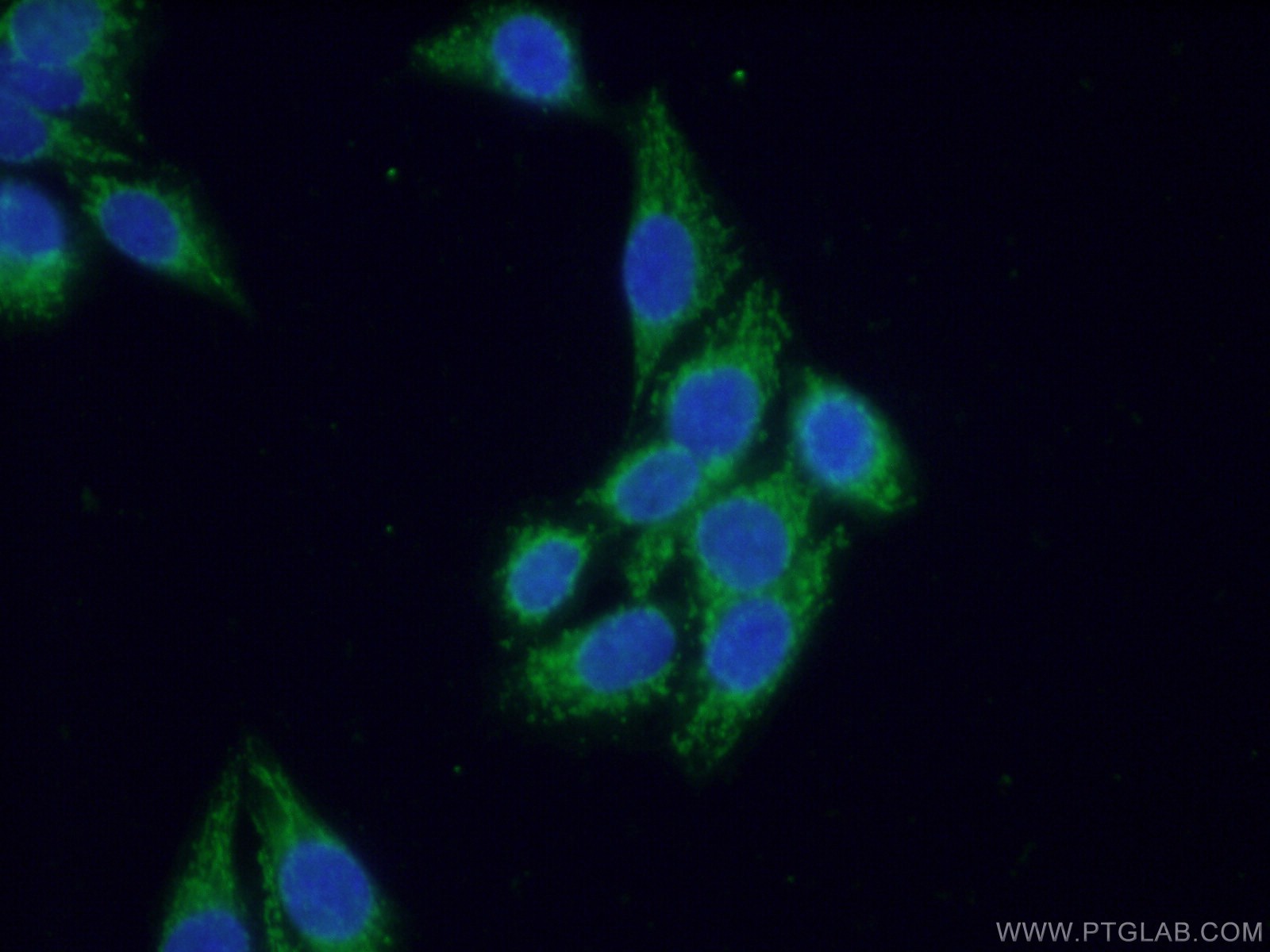 IF Staining of HeLa using 12751-1-AP