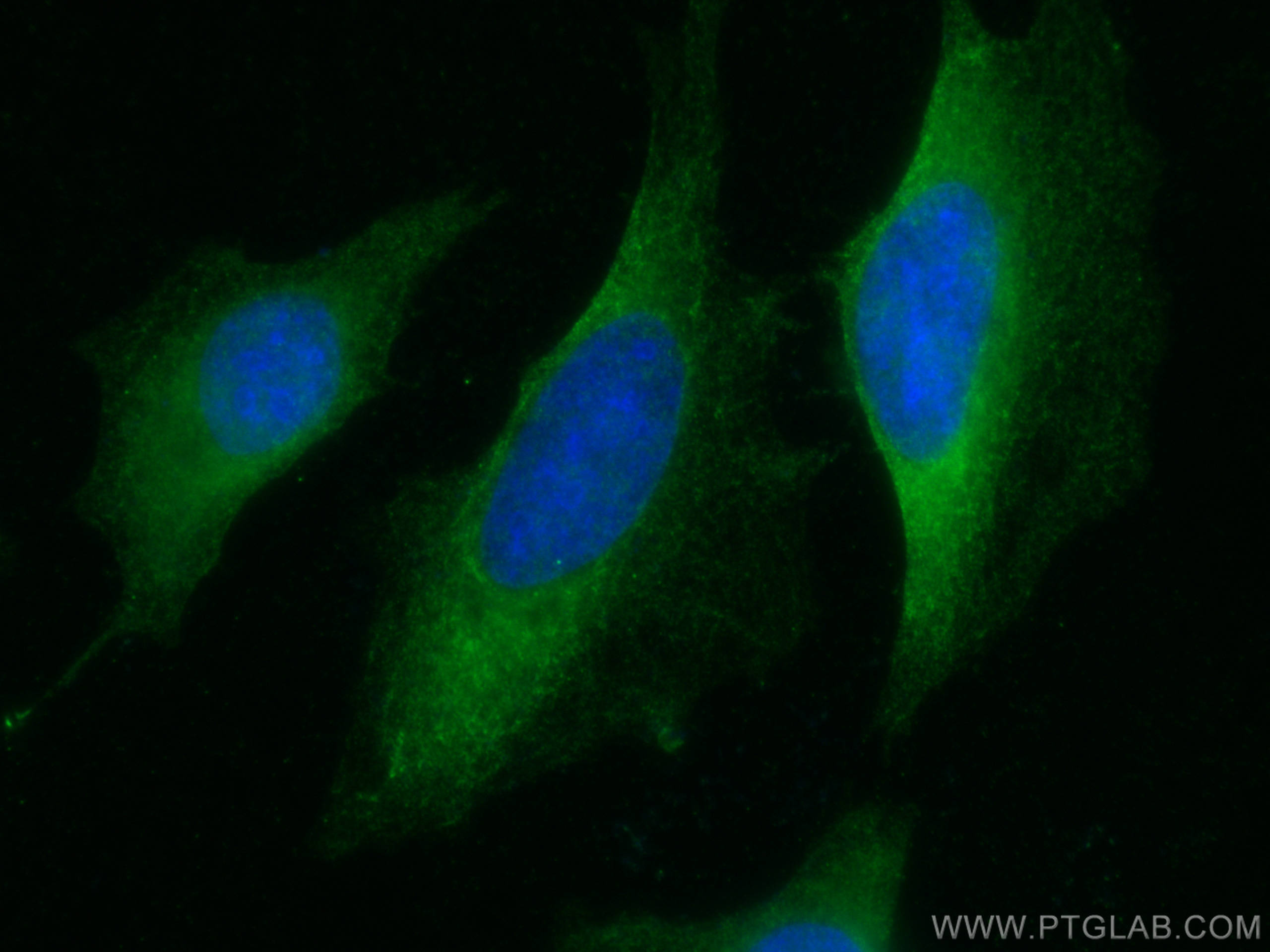 IF Staining of HeLa using 66011-1-Ig (same clone as 66011-1-PBS)