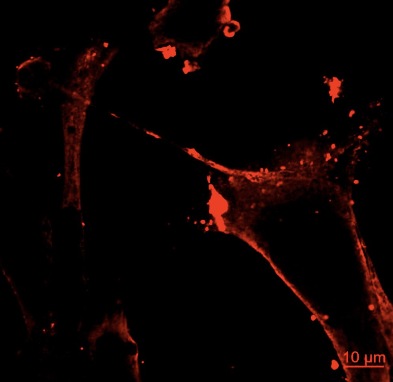 IF Staining of MDA-MB-231 using 66011-1-Ig (same clone as 66011-1-PBS)