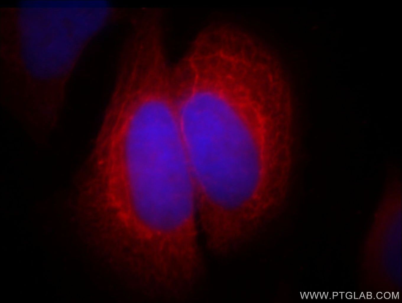 SEC5/EXOC2 Monoclonal antibody