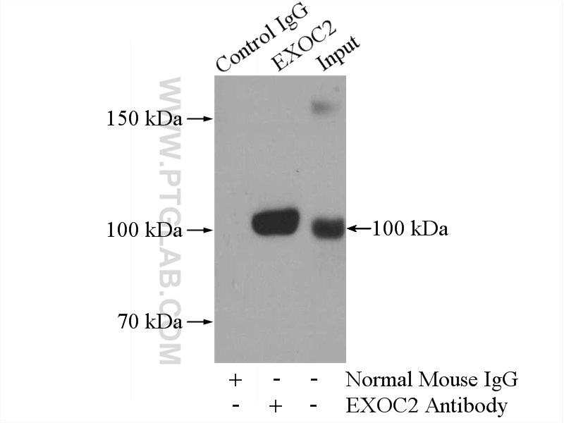 IP experiment of mouse brain using 66011-1-Ig (same clone as 66011-1-PBS)