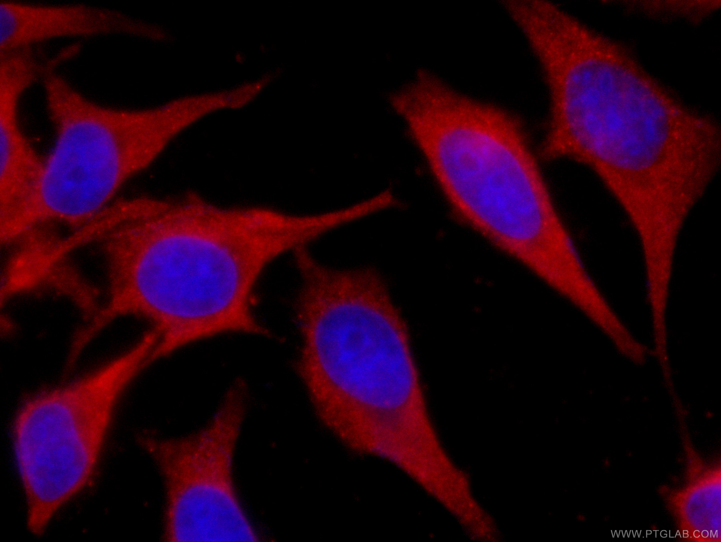 IF Staining of HeLa using CL594-66011