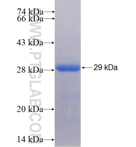 SEC61A1 fusion protein Ag7478 SDS-PAGE SEC61A1 fusion protein Ag7478 SDS-PAGE