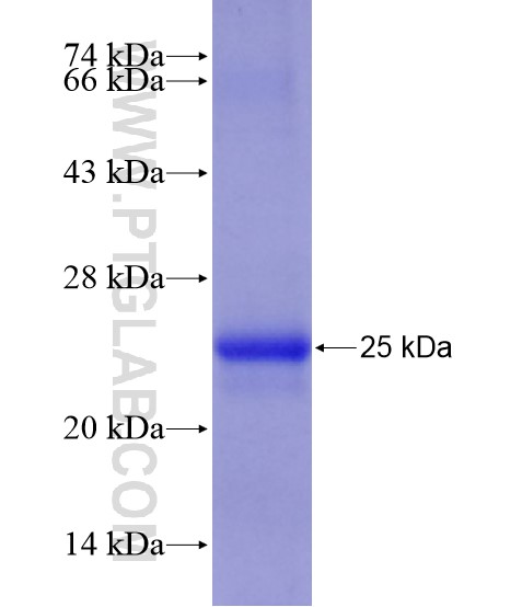 SEC61A2 fusion protein Ag20779 SDS-PAGE