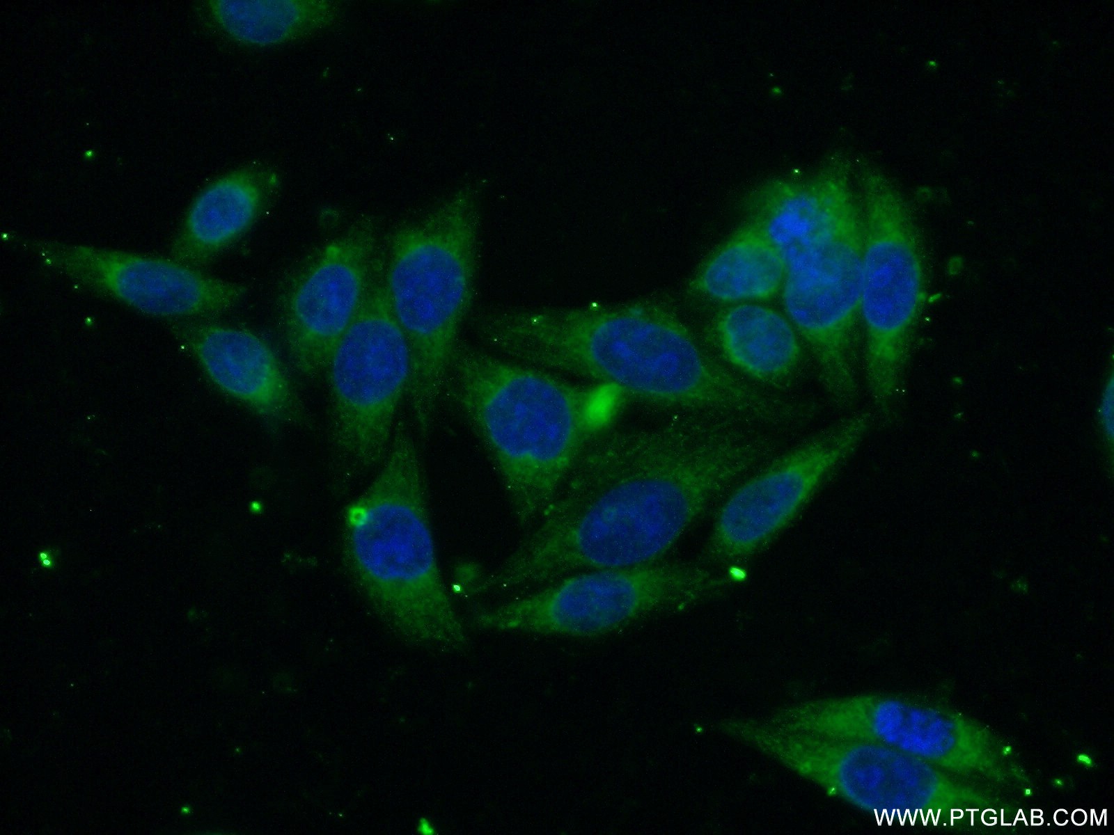 SEC61B antibody (15087-1-AP) | Proteintech | 武汉三鹰生物技术有限公司