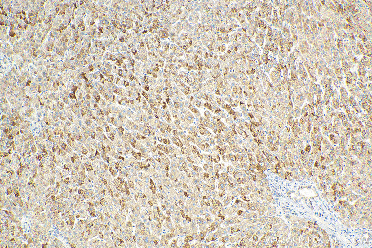 IHC staining of human liver using 15087-1-AP
