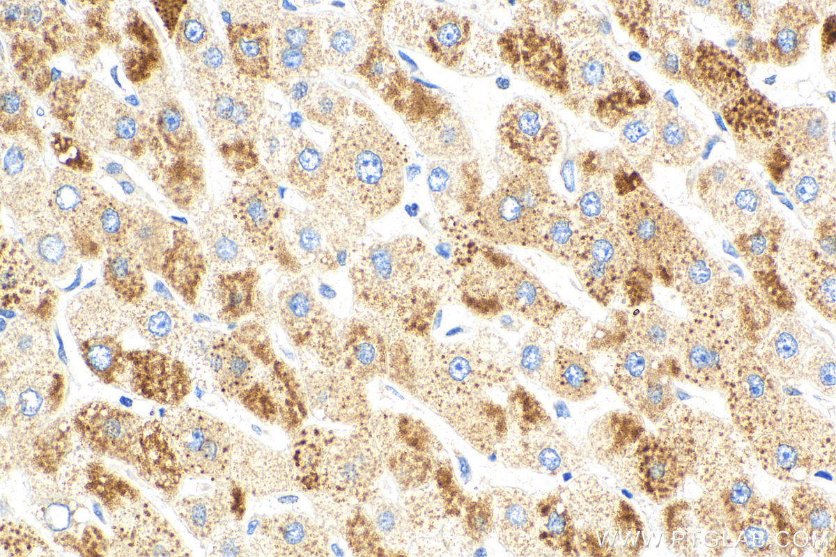 IHC staining of human liver using 15087-1-AP